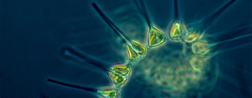 Multiple plankton cells and a band