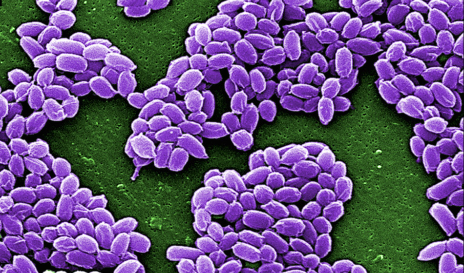 Clumps of oval-shaped bacterial